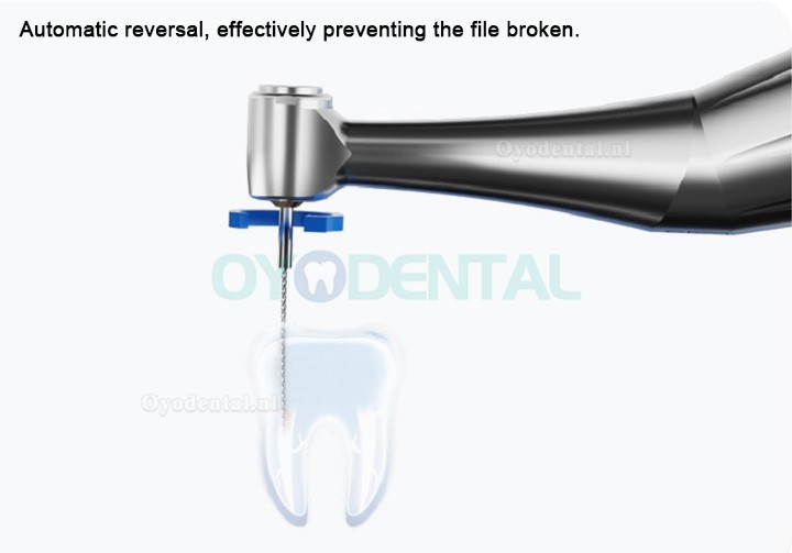 Refine Maxdo Tandheelkundige draadloze endodontische motor met heen en weer bewegen